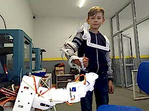 Экзоскелет для реабилитации верхних конечностей методом зеркальной терапии